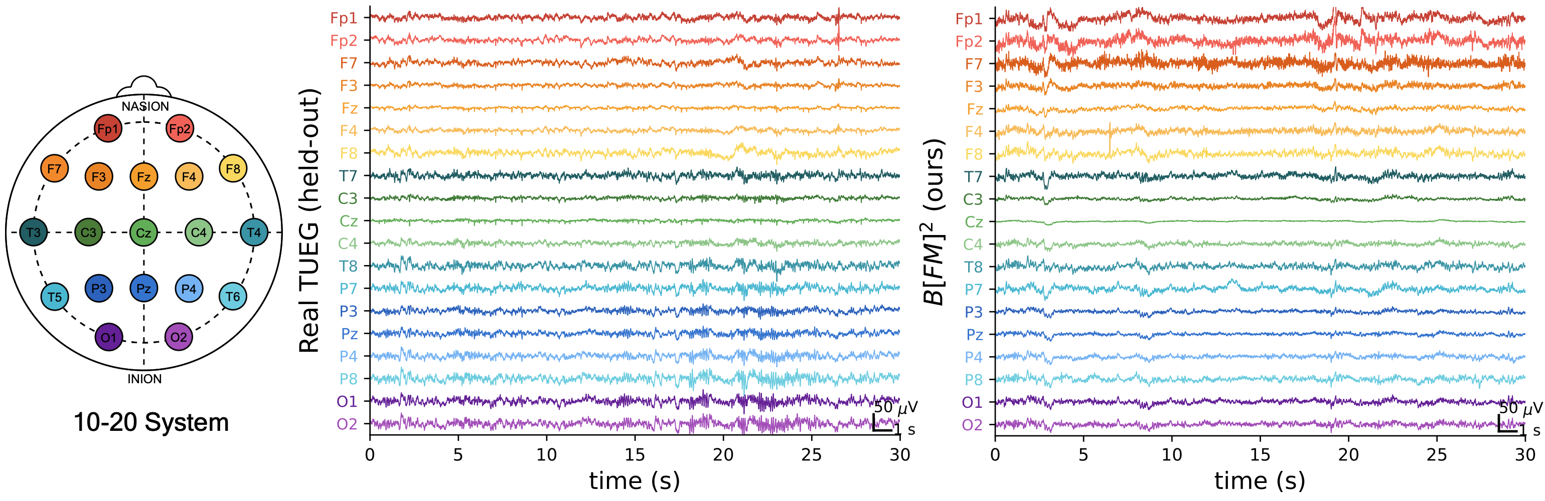 A real held-out TUEG segment and a B[FM]2 sample side by side in the 10-20 montage.