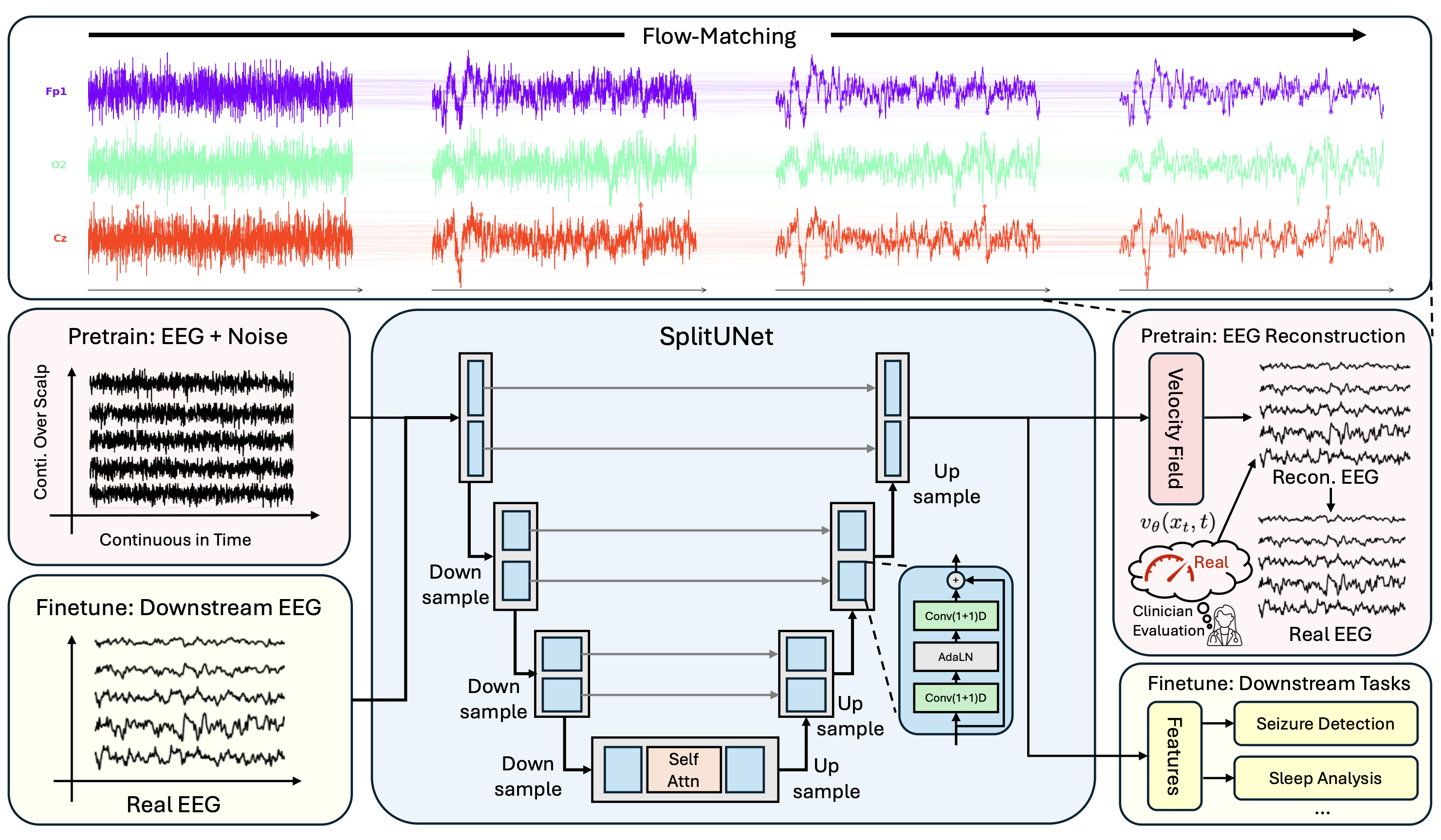 Overview of B[FM]2: flow matching maps Gaussian noise to continuous multi-channel EEG; SplitUNet operates on the raw waveform; penultimate features feed a linear head.